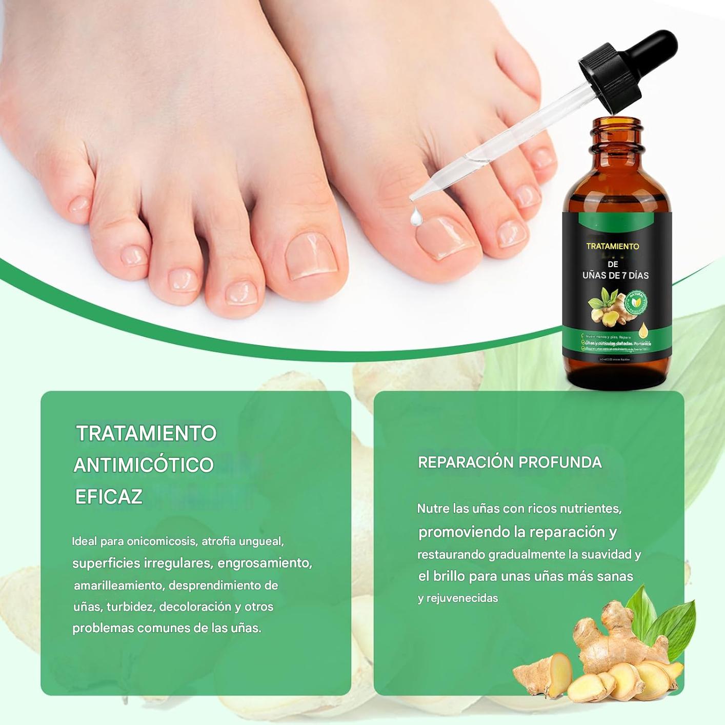 Tratamiento Antihongos para Uñas 60ml – Con Extracto de Jengibre | Repara, Fortalece y Regenera Uñas de Manos y Pies