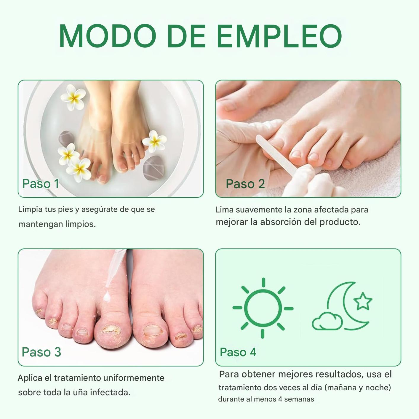 Tratamiento Antihongos para Uñas 60ml – Con Extracto de Jengibre | Repara, Fortalece y Regenera Uñas de Manos y Pies