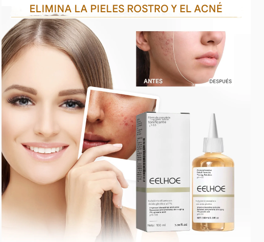 Tónico Facial con Ácido Glicólico 7% – Exfoliante Suave, Antiacné, Reafirmante y Reductor de Poros 100ml