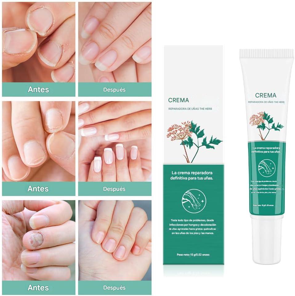 Solución Antimicótica Profunda – Ponle Fin a las Uñas Amarillas y Engrosadas