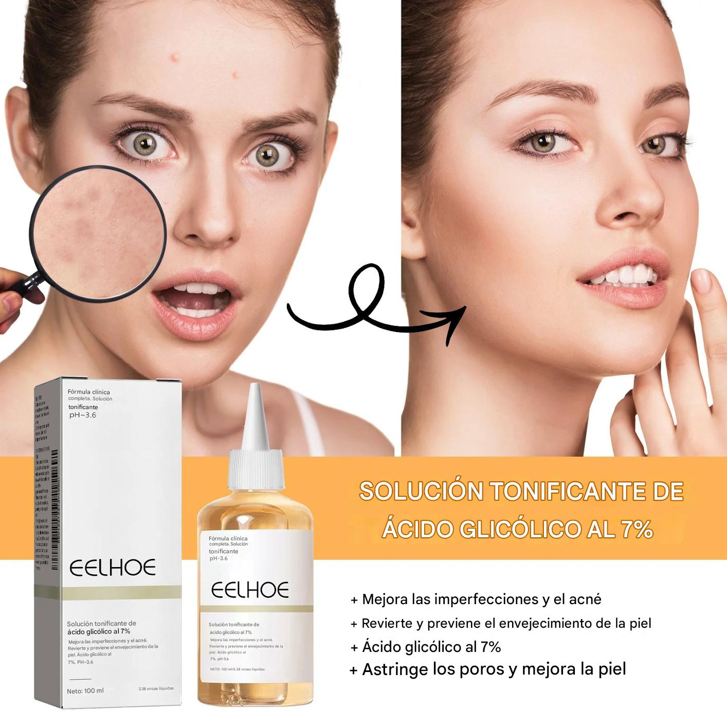 Tónico Facial con Ácido Glicólico 7% – Exfoliante Suave, Antiacné, Reafirmante y Reductor de Poros 100ml