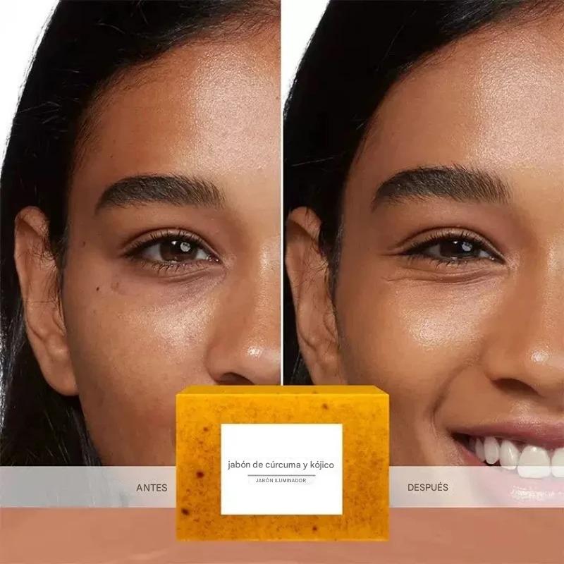 Jabón Natural de Cúrcuma, Ácido Kójico y Limón – Orgánico, Artesanal y Aclarante para Rostro y Cuerpo