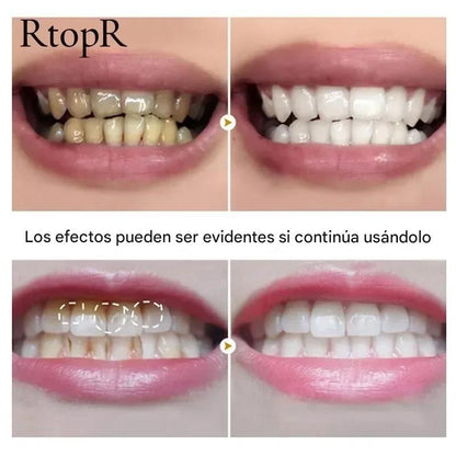 Polvo Blanqueador Dental Natural con Esencia de Perla. Elimina Manchas y Placa. Sonrisa Blanca y Aliento Fresco 55g