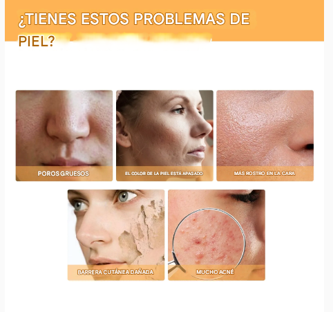 Tónico Facial con Ácido Glicólico 7% – Exfoliante Suave, Antiacné, Reafirmante y Reductor de Poros 100ml