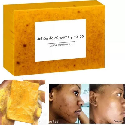 Jabón Natural de Cúrcuma, Ácido Kójico y Limón – Orgánico, Artesanal y Aclarante para Rostro y Cuerpo